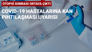 Covid-19 hastalarına önemli uyarı