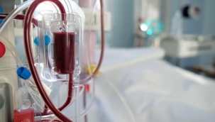 Coronaya karşı kan temizleme yöntemi