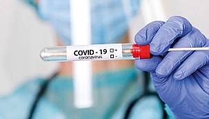 Türkiye'de son 24 saatte 103 kişi hayatını kaybetti 3819 yeni Covid-19 tanısı kondu 