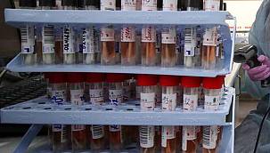  ​Türkiye'de son 24 saatte 87 kişi Covid-19'dan hayatını kaybetti 