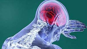 Her yıl 17 milyon insanı etkileyen felcin 7 önemli sebebi 