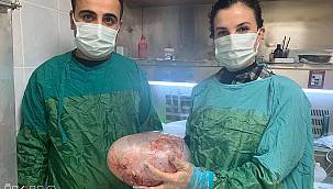 Karın ağrısı diye gittiği hastanede, karnından 5 kg kitle çıkarıldı