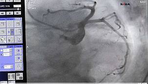 Sağlıklı bir kalp için yapılması gerekenler