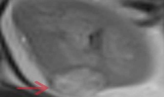 Ağrı'da sağlık alanında ilk defa bu operasyon yapıldı